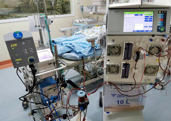 picu-1.jpg